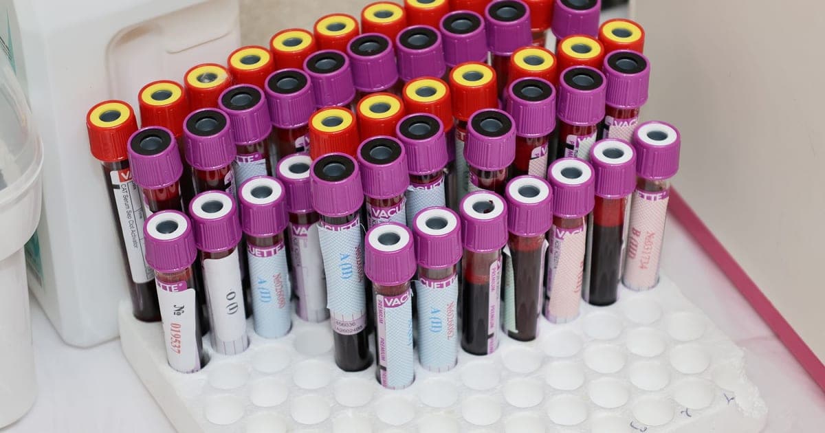 Blood collection tube and pathology request form on a clinic desk, the vitamin D test worth having for reasons other than testosterone